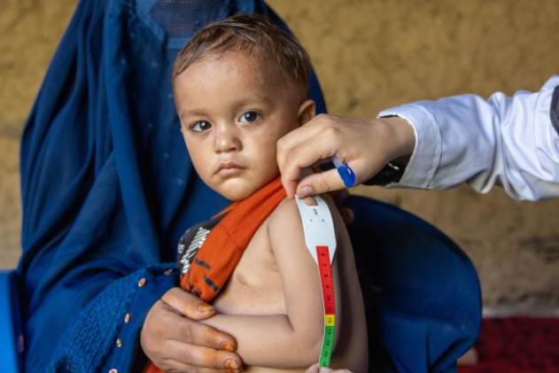 A child's mid upper arm circumference is measured by IRC staff member, using a malnutrition measurement tape for identifying acute malnutrition.