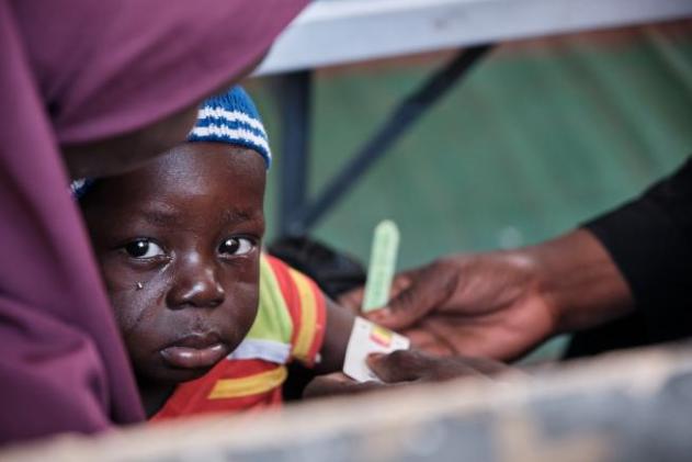 A child's mid upper arm circumference is measured by IRC staff member, using a malnutrition measurement tape for identifying acute malnutrition.