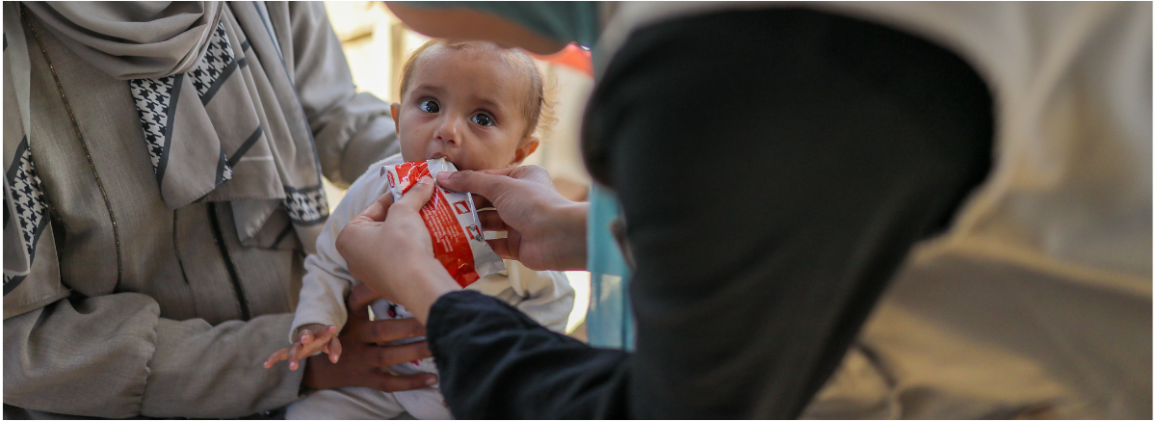 A child receiving malnutrition treatment in Gaza.